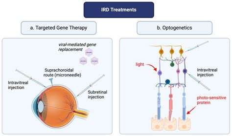 Optogenetics Provides Lasting Vision Recovery for Blind Patients After Nearly Three Years